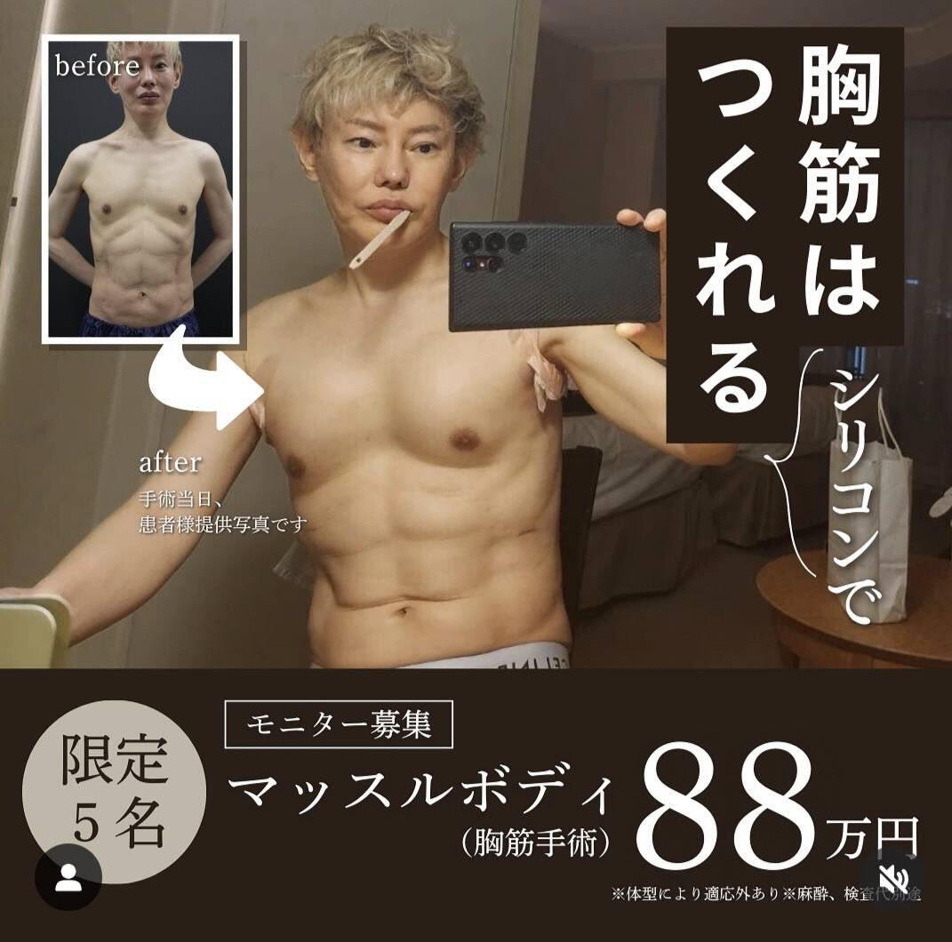 マッスルハイブリッド豊胸