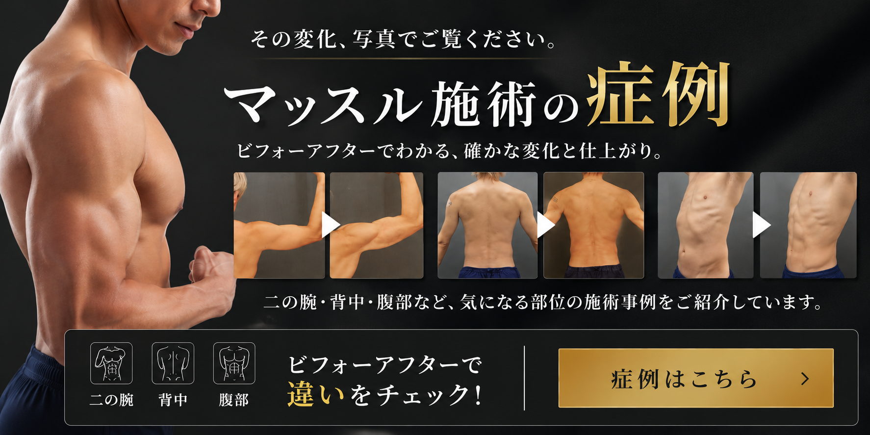 マッスル施術・メンズ整形の症例
