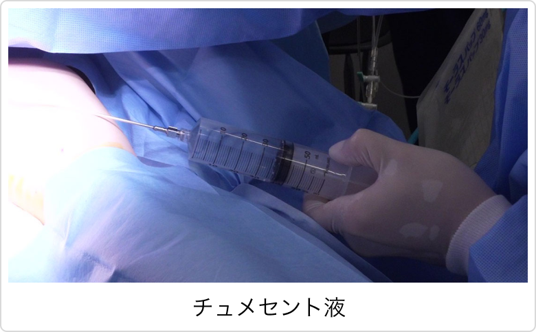 チュメセント液