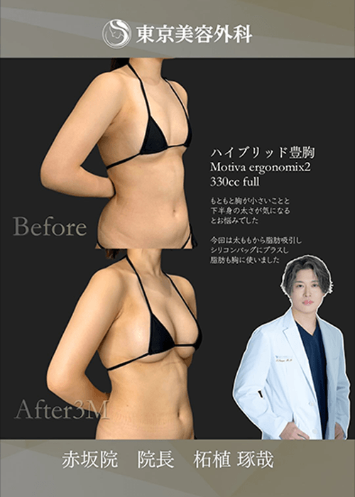 柘植医師インスタ