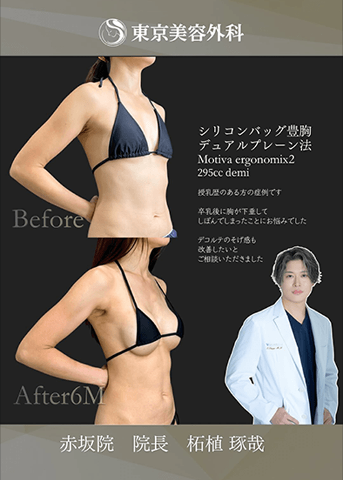 柘植医師インスタ