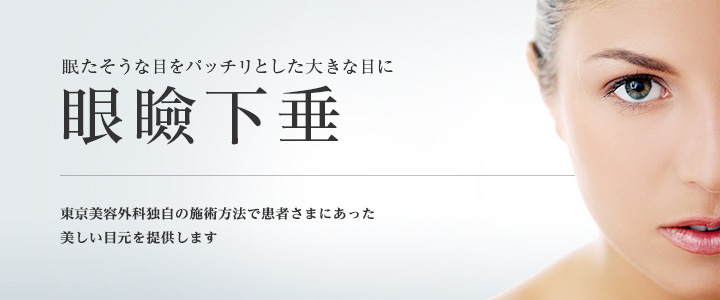 魅力的で自然な仕上がりに 眼瞼下垂・オープンアイズ