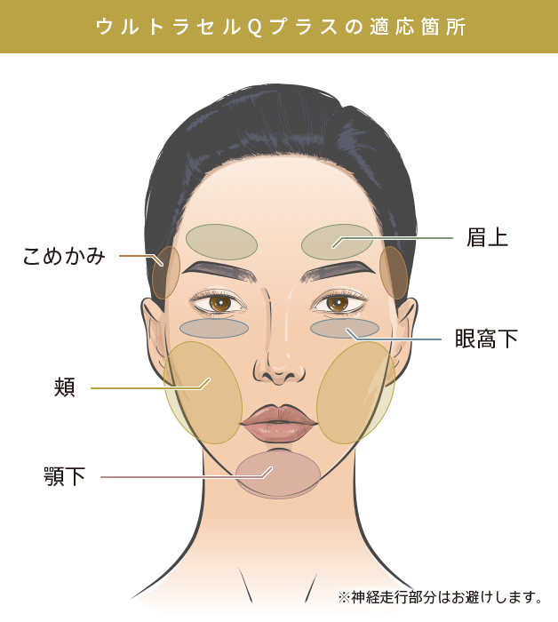 ウルトラセルQプラス（ULTRAcel Q+）の適応箇所